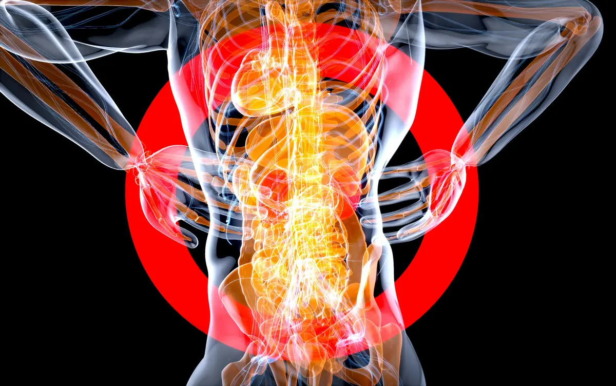 Douleurs du Dos : Lombalgies, Cervicalgies et Sciatique