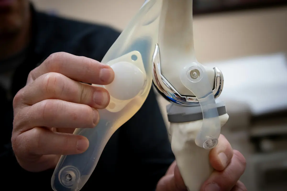 Prothèse Totale du Genou : Guide Complet par votre Orthopédiste à Témara